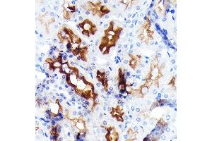 Immunohistochemistry of paraffin-embedded rat kidney using P Glycoprotein Rabbit mAb (ABIN7265732) at dilution of 1:100 (40x lens). (ABCB1 Antikörper)
