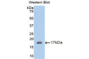 Western Blotting (WB) image for anti-Retinoic Acid Receptor Responder (Tazarotene Induced) 2 (RARRES2) (AA 33-158) antibody (ABIN1858395)