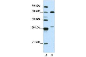 WB Suggested Anti-HNRPL  Antibody Titration: 0.