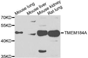 Western blot analysis of extracts of various cells, using TMEM184A antibody. (TMEM184A Antikörper)