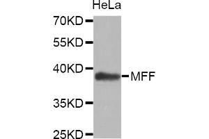 Western blot analysis of extracts of HeLa cells, using MFF antibody (ABIN5972807). (MFF Antikörper)