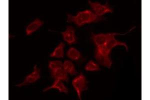 ABIN6267490 staining K562 by IF/ICC. (VEGFR2/CD309 Antikörper  (pTyr1059))