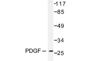 Image no. 1 for anti-Platelet Derived Growth Factor Subunit B (PDGFB) antibody (ABIN271781) (PDGFB Antikörper)