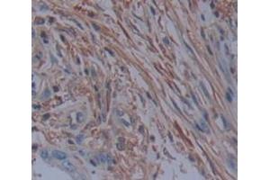 IHC-P analysis of Human Tissue, with DAB staining. (PDE4D Antikörper  (AA 581-809))