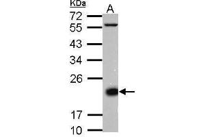 WB Image Sample (30 ug of whole cell lysate) A: Jurkat membrane 12% SDS PAGE antibody diluted at 1:10000 (CD3D Antikörper  (Center))