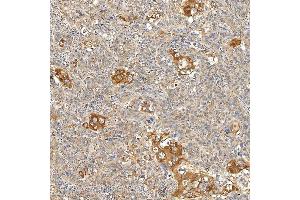 IHC analysis of SNPH using anti-SNPH antibody (ABIN7601724). (Syntaphilin Antikörper  (AA 43-482))