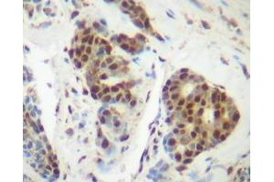 Image no. 1 for anti-Tumor Necrosis Factor alpha (TNF alpha) antibody (ABIN465605) (TNF alpha Antikörper)