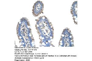 Rabbit Anti-SLC22A1 Antibody  Paraffin Embedded Tissue: Human Intestine Cellular Data: Epithelial cells of intestinal villas Antibody Concentration: 4. (SLC22A1 Antikörper  (N-Term))