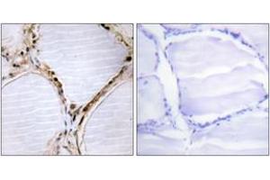 Immunohistochemistry (IHC) image for anti-BMX Non-Receptor Tyrosine Kinase (BMX) (AA 532-581) antibody (ABIN2888766) (BMX Antikörper  (AA 532-581))