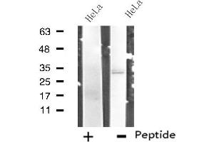 Western blot analysis of extracts from HeLa cells, using RNF144B antibody. (RNF144B Antikörper  (Internal Region))