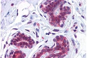 Human Breast: Formalin-Fixed, Paraffin-Embedded (FFPE) (CCDC106 Antikörper  (C-Term))