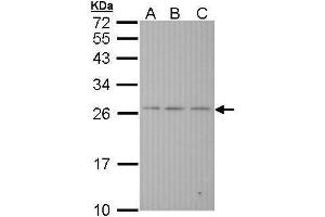 WB Image Sample (30 ug of whole cell lysate) A: Hela B: Hep G2 , C: Molt-4 , 12% SDS PAGE antibody diluted at 1:1000 (BAK1 Antikörper  (N-Term))