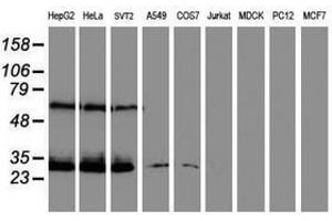 Image no. 2 for anti-Centromere Protein H (CENPH) antibody (ABIN1497470) (CENPH Antikörper)