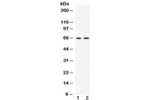 Western blot testing of 1) rat testis and 2) human MCF7 lysate with CCDC6 antibody at 0. (CCDC6 Antikörper  (AA 156-198))