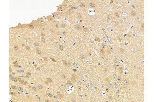 ABIN6255313 and ABIN6267193 at 1/100 staining Rat brain tissue by IHC-P. (tau Antikörper  (pSer416, pSer733))