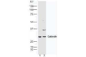 Lane1: Mouse kidney lysate, Lane2: Mouse brain lysate probed with Rabbit Anti-Calbindin Polyclonal Antibody, Unconjugated (ABIN2559729) at 1:300 in 4˚C. (CALB1 Antikörper  (AA 41-150))