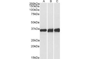 Western Blotting (WB) image for anti-Lactate Dehydrogenase B (LDHB) antibody (ABIN5870352) (LDHB Antikörper)