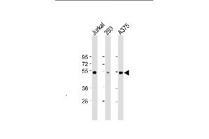 All lanes : Anti-RBCK1 (UBCE7IP3) Antibody at 1:2000 dilution Lane 1: Jurkat whole cell lysate Lane 2: 293 whole cell lysate Lane 3:  whole cell lysate Lysates/proteins at 20 μg per lane. (RBCK1 Antikörper)