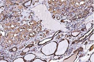 IHC analysis of ORP150/HYOU1 using anti-ORP150/HYOU1 antibody (ABIN7601807).