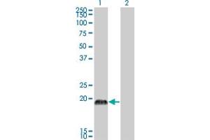 Western Blot analysis of CSRP3 expression in transfected 293T cell line by CSRP3 monoclonal antibody (M03), clone 6D2. (CSRP3 Antikörper  (AA 95-194))