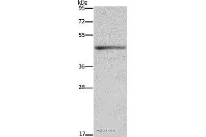 Western blot analysis of Mouse heart tissue, using IL5RA Polyclonal Antibody at dilution of 1:650 (IL5RA Antikörper)