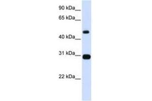 Image no. 1 for anti-Proteasome (Prosome, Macropain) 26S Subunit, ATPase, 3 (PSMC3) (AA 101-134) antibody (ABIN6741431) (PSMC3 Antikörper  (AA 101-134))