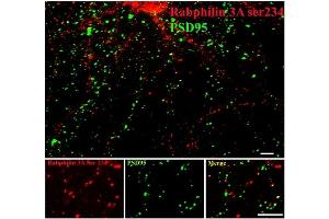 Image no. 2 for anti-Rabphilin 3A (RPH3A) (pSer234) antibody (ABIN372710) (RPH3A Antikörper  (pSer234))