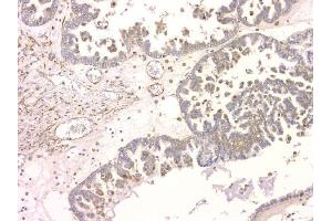 IHC analysis of SRCIN1 using anti-SRCIN1 antibody (ABIN6719623). (SRCIN1 Antikörper  (AA 189-287))