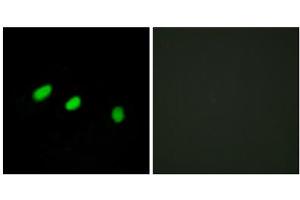 Immunofluorescence analysis of HeLa cells, using TRA-2 alpha antibody. (TRA2A Antikörper  (C-Term))