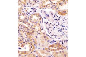 Antibody staining PCCA in human kidney tissue sections by Immunohistochemistry (IHC-P - paraformaldehyde-fixed, paraffin-embedded sections). (PCCA Antikörper  (AA 362-390))