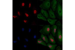 ABIN6257532 and ABIN6275728 staining  cells by IF/ICC. (THO Complex 4 Antikörper  (Internal Region))