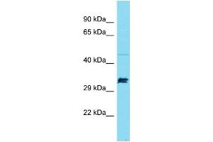 Western Blotting (WB) image for anti-Suppressor of Ty 7 Like (SUPT7L) (Middle Region) antibody (ABIN2790711)