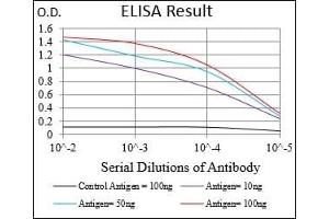 Black line: Control Antigen (100 ng), Purple line: Antigen(10 ng), Blue line: Antigen (50 ng), Red line: Antigen (100 ng), (Retinoblastoma 1 Antikörper  (AA 2106-2784))