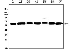 Western blot analysis of CALR using anti-CALR antibody (ABIN7600329).