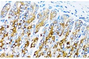 Immunohistochemistry of paraffin-embedded Mouse stomach using ACVR1C Polyclonal Antibody at dilution of 1:100 (40x lens). (ACVR1C/ALK7 Antikörper)
