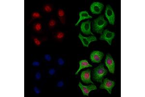 ABIN7094692 and ABIN7098743 staining Hela cells by IF/ICC.