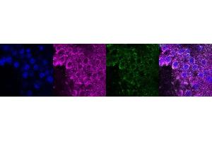 Immunohistochemistry (IHC) image for anti-Coiled-Coil Domain Containing 153 (CCDC153) antibody (ABIN7456205) (CCDC153 Antikörper)