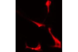 ABIN6274360 staining COLO205 cells by IF/ICC. (PSMD2 Antikörper  (Internal Region))