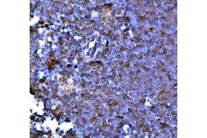 IHC analysis of PD1/Pdcd1 using anti-PD1/Pdcd1 antibody (ABIN7601831).