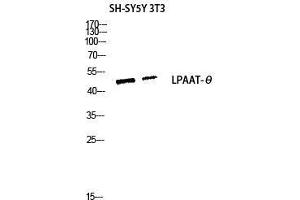 Western Blot (WB) analysis of SH-SY5Y 3T3 lysis using LPAAT-theta antibody. (AGPAT9 Antikörper  (C-Term))