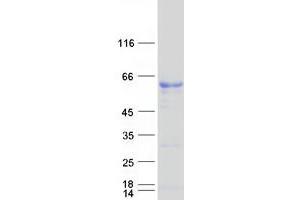 Validation with Western Blot (SAAL1 Protein (Myc-DYKDDDDK Tag))