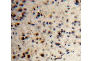 IHC-P analysis of Brain tissue, with DAB staining. (KISS1 Antikörper  (AA 1-126))
