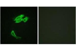 Immunofluorescence analysis of HeLa cells, using PEA-15 (Ab-116) Antibody. (PEA15 Antikörper  (AA 81-130))