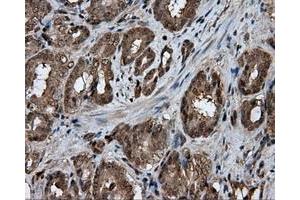 Immunohistochemical staining of paraffin-embedded liver tissue using anti-GBE1 mouse monoclonal antibody. (GBE1 Antikörper)