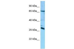 Western Blotting (WB) image for anti-DCN1, Defective in Cullin Neddylation 1, Domain Containing 4 (DCUN1D4) (Middle Region) antibody (ABIN2788475) (DCUN1D4 Antikörper  (Middle Region))