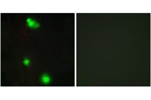 Immunofluorescence analysis of MCF7 cells, using SFRS3 Antibody. (SRSF3 Antikörper  (AA 111-160))