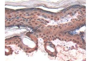 DAB staining on IHC-P; Samples: Rat Skin Tissue (LGALS7 Antikörper  (AA 1-128))