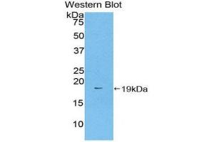 Western Blotting (WB) image for anti-Coagulation Factor II (thrombin) (F2) (AA 44-200) antibody (ABIN1077942)