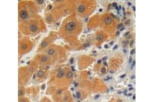 Used in DAB staining on fromalin fixed paraffin-embedded liver tissue (GPLD1 Antikörper  (AA 496-840))