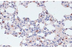 Immunohistochemistry of paraffin-embedded Mouse lung using LYZ Polyclonal Antibody at dilution of 1:100 (40x lens). (LYZ Antikörper)